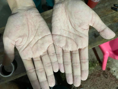 衣服干了又湿，湿了又干——千名驰援吴川核酸采检人员群像